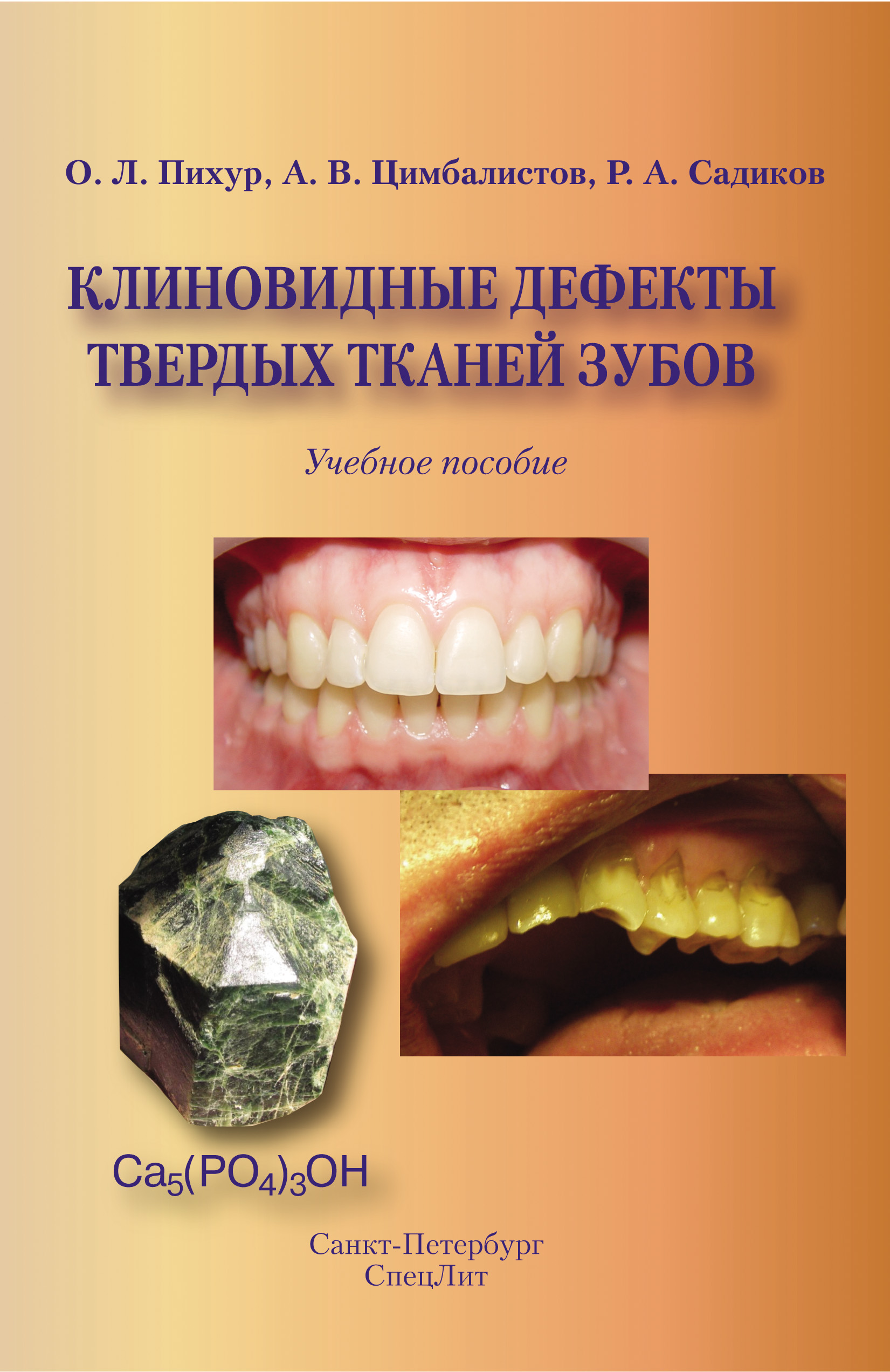Обложка книги «Клиновидные дефекты твердых тканей зубов»