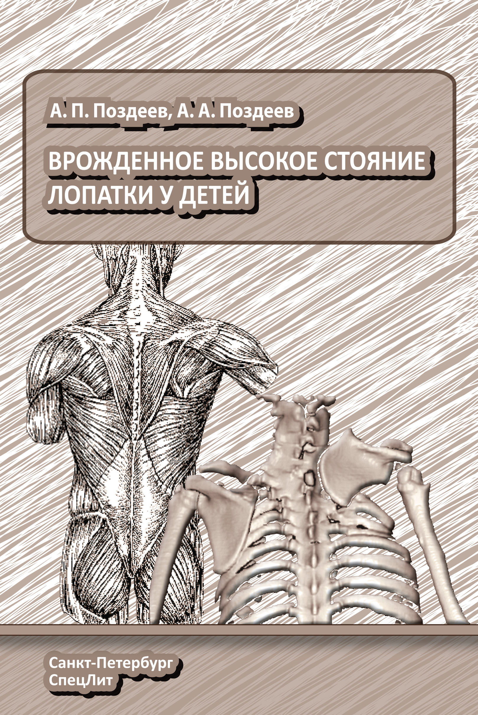 Обложка книги «Врожденное высокое стояние лопатки у детей»