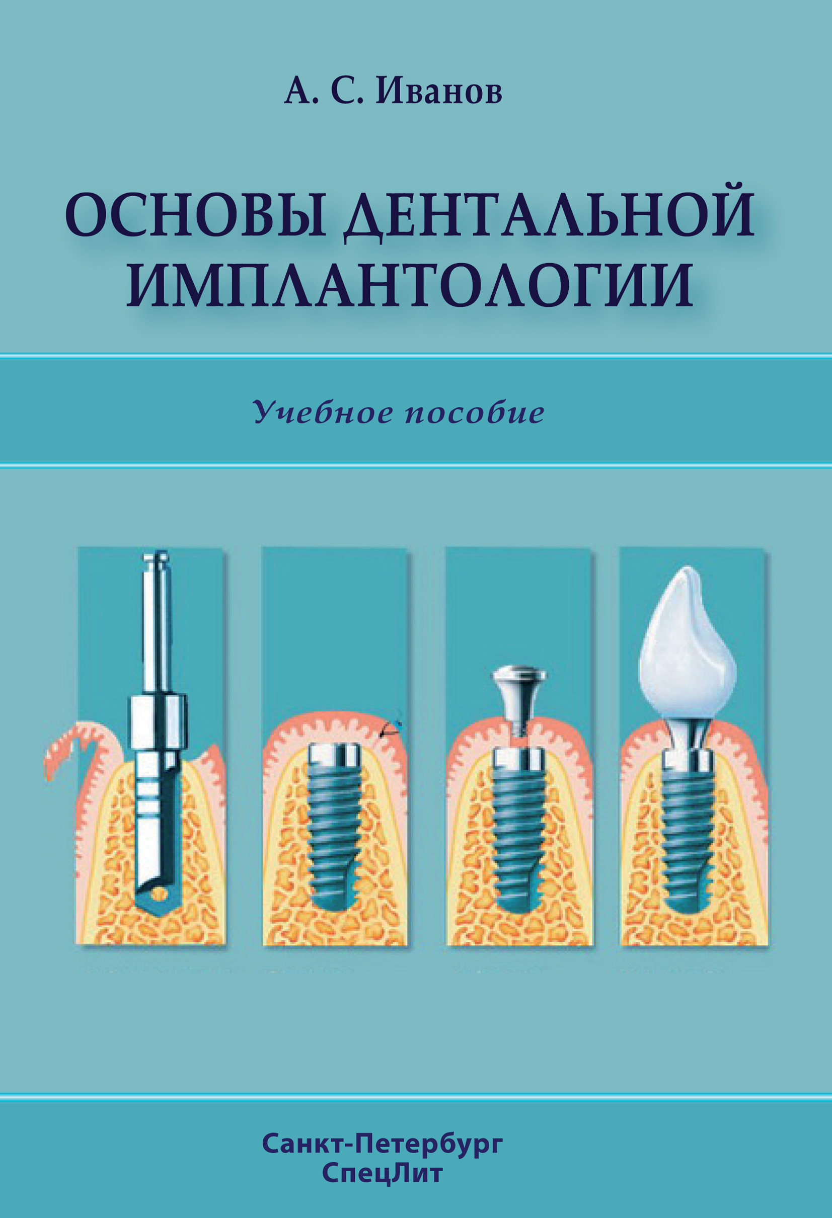 Обложка книги «Основы дентальной имплантологии»
