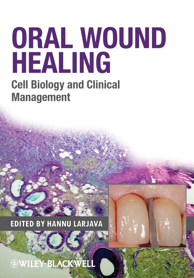 Обложка книги «Oral Wound Healing. Cell Biology and Clinical Management»