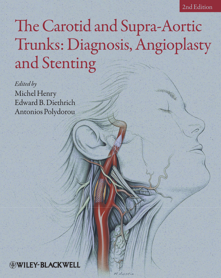 Обложка книги «The Carotid and Supra-Aortic Trunks. Diagnosis, Angioplasty and Stenting»