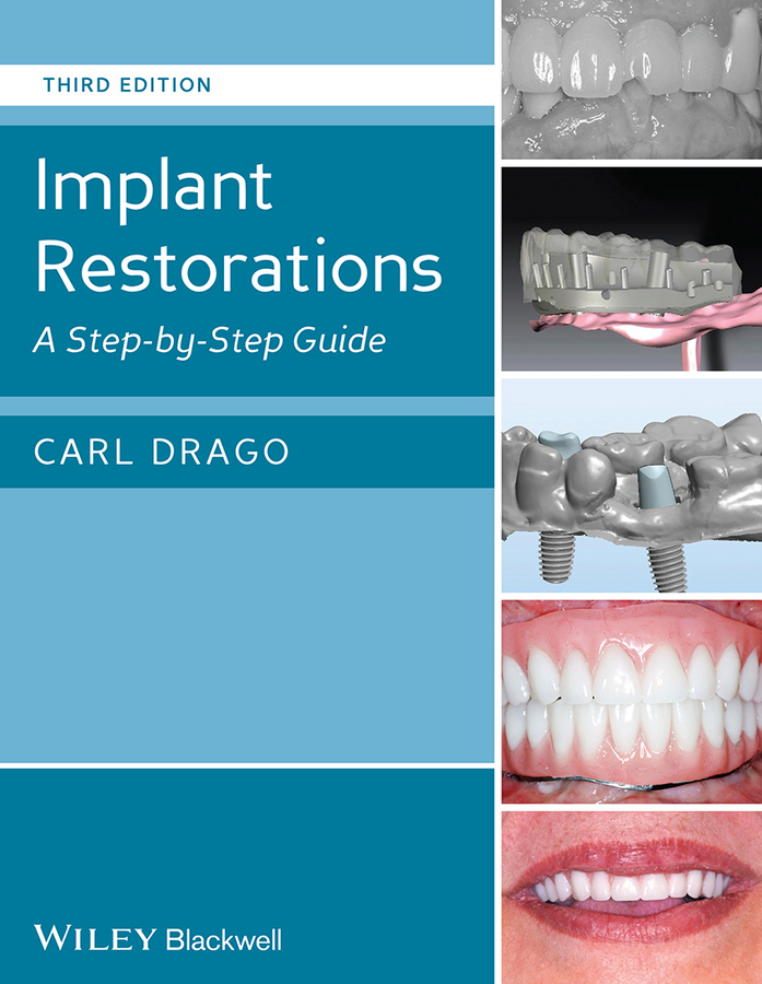 Обложка книги «Implant Restorations. A Step-by-Step Guide»