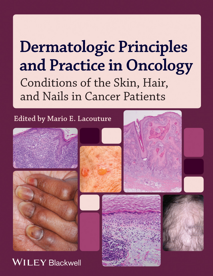 Обложка книги «Dermatologic Principles and Practice in Oncology. Conditions of the Skin, Hair, and Nails in Cancer Patients»