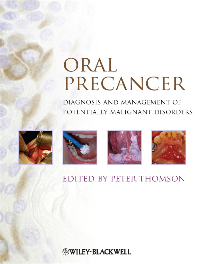 Обложка книги «Oral Precancer. Diagnosis and Management of Potentially Malignant Disorders»