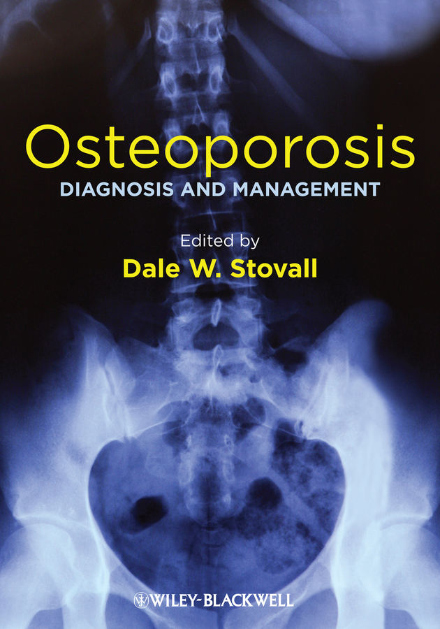 Обложка книги «Osteoporosis. Diagnosis and Management»