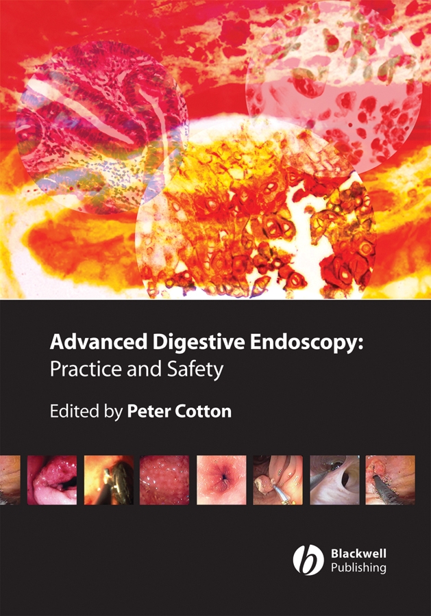 Обложка книги «Advanced Digestive Endoscopy. Practice and Safety»