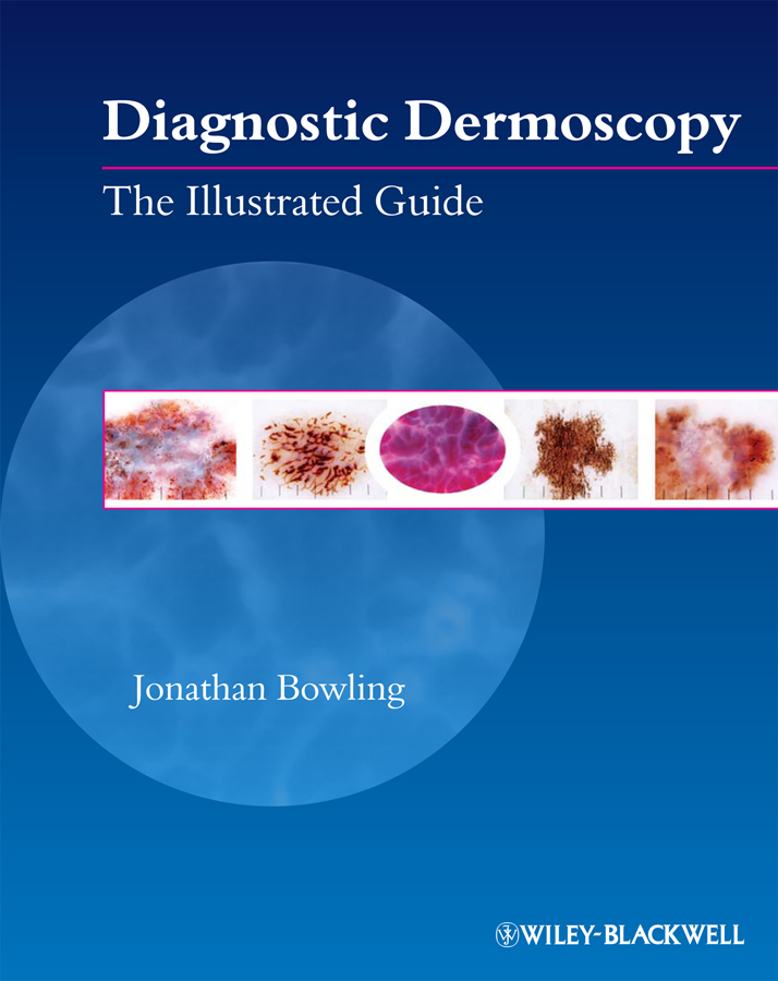 Обложка книги «Diagnostic Dermoscopy. The Illustrated Guide»