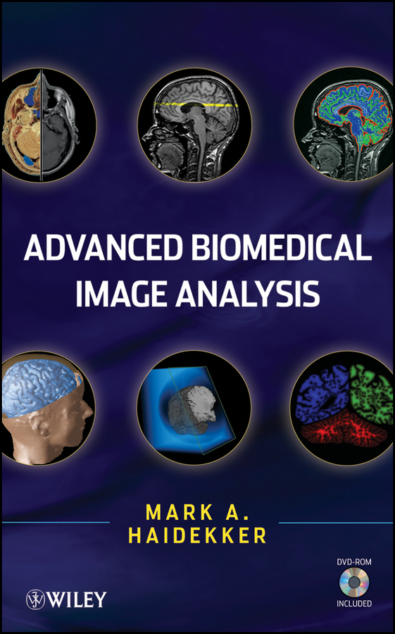 Обложка книги «Advanced Biomedical Image Analysis»