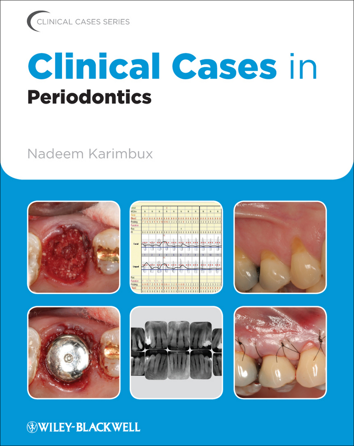 Обложка книги «Clinical Cases in Periodontics»