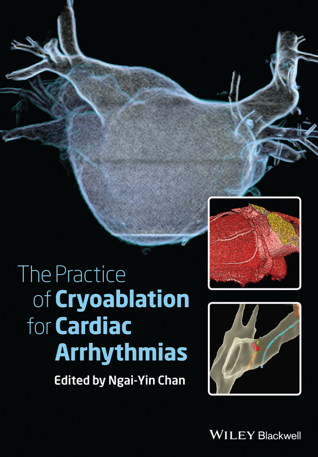 Обложка книги «The Practice of Catheter Cryoablation for Cardiac Arrhythmias»