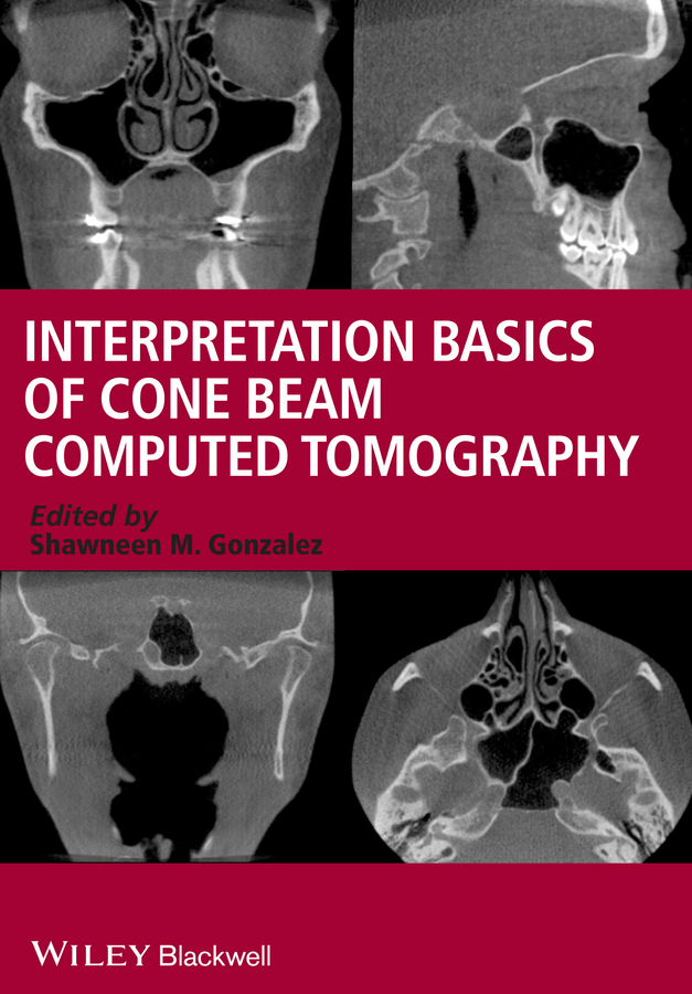 Обложка книги «Interpretation Basics of Cone Beam Computed Tomography»