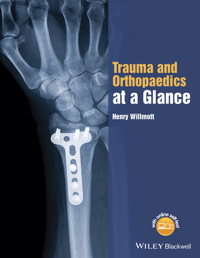 Обложка книги «Trauma and Orthopaedics at a Glance»