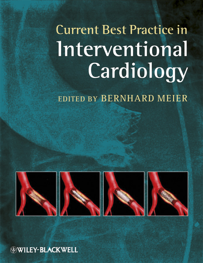 Обложка книги «Current Best Practice in Interventional Cardiology»