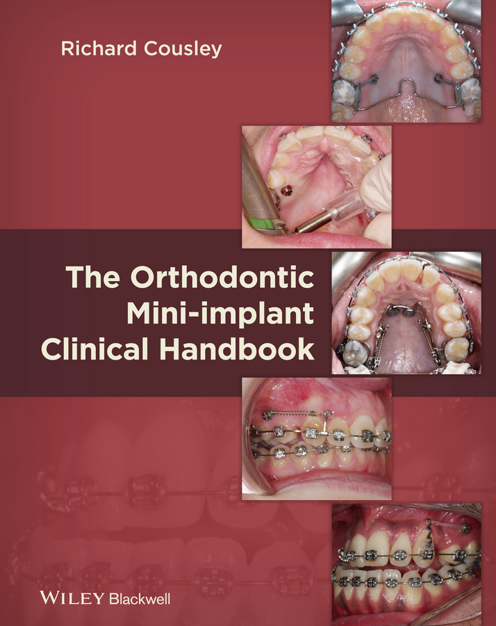 Обложка книги «The Orthodontic Mini-implant Clinical Handbook»