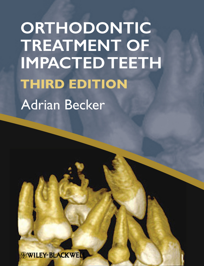 Обложка книги «Orthodontic Treatment of Impacted Teeth»