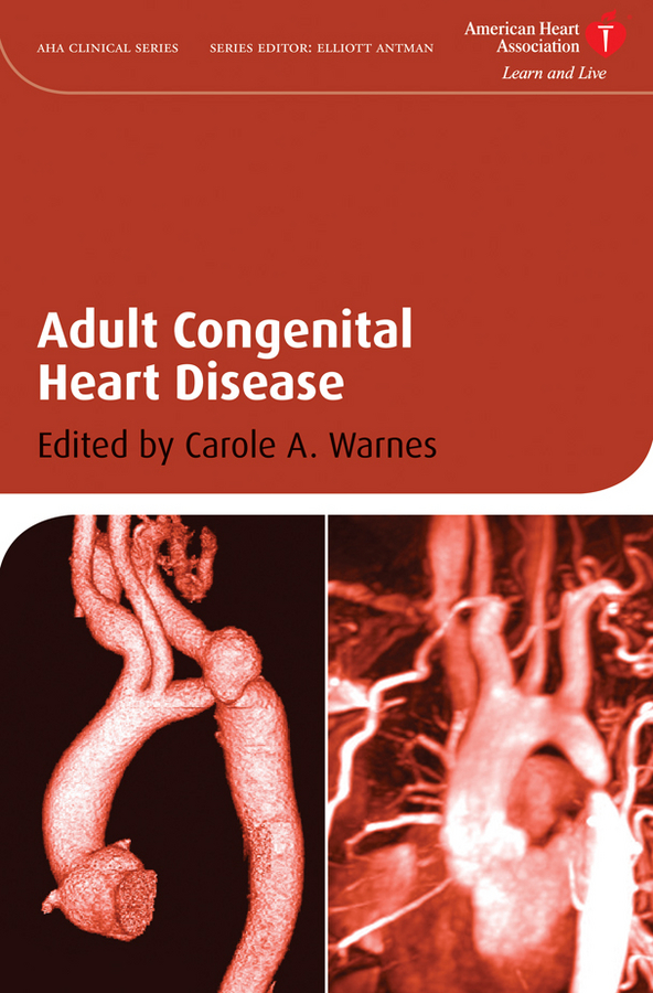 Обложка книги «Adult Congenital Heart Disease»