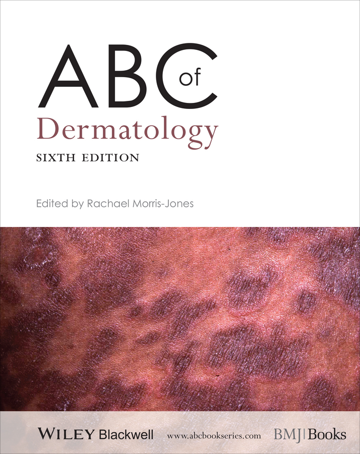 Обложка книги «ABC of Dermatology»
