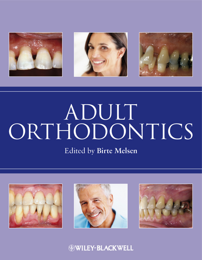 Обложка книги «Adult Orthodontics»