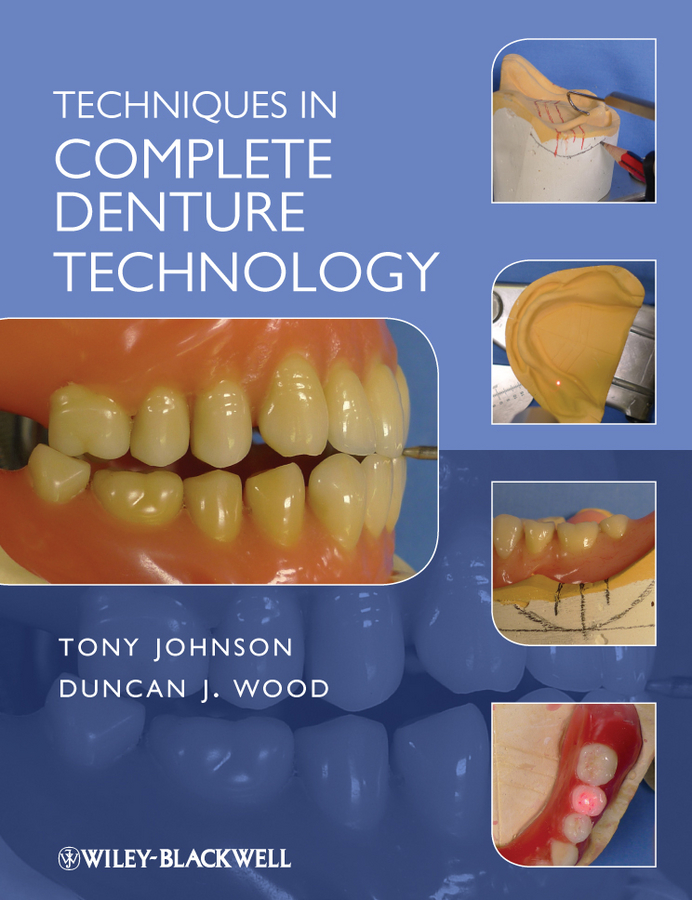 Обложка книги «Techniques in Complete Denture Technology»