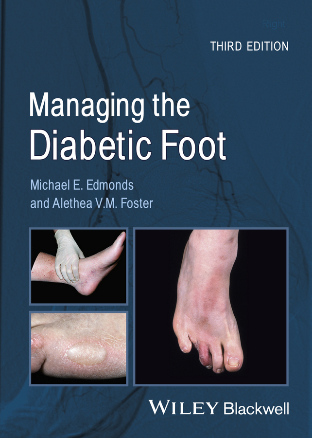 Обложка книги «Managing the Diabetic Foot»
