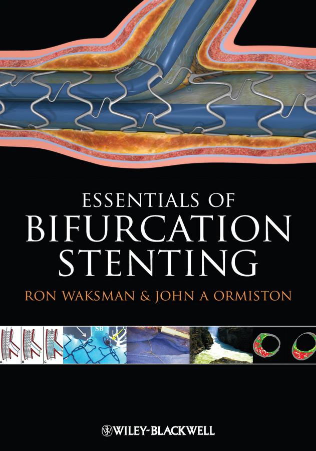 Обложка книги «Bifurcation Stenting»