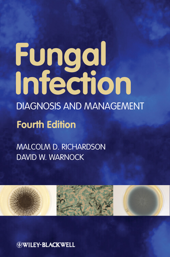 Обложка книги «Fungal Infection. Diagnosis and Management»