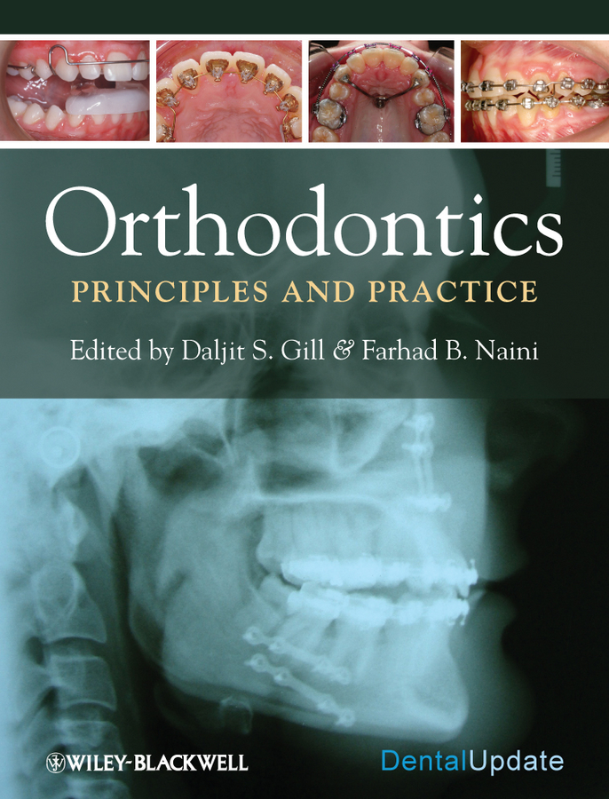 Обложка книги «Orthodontics. Principles and Practice»
