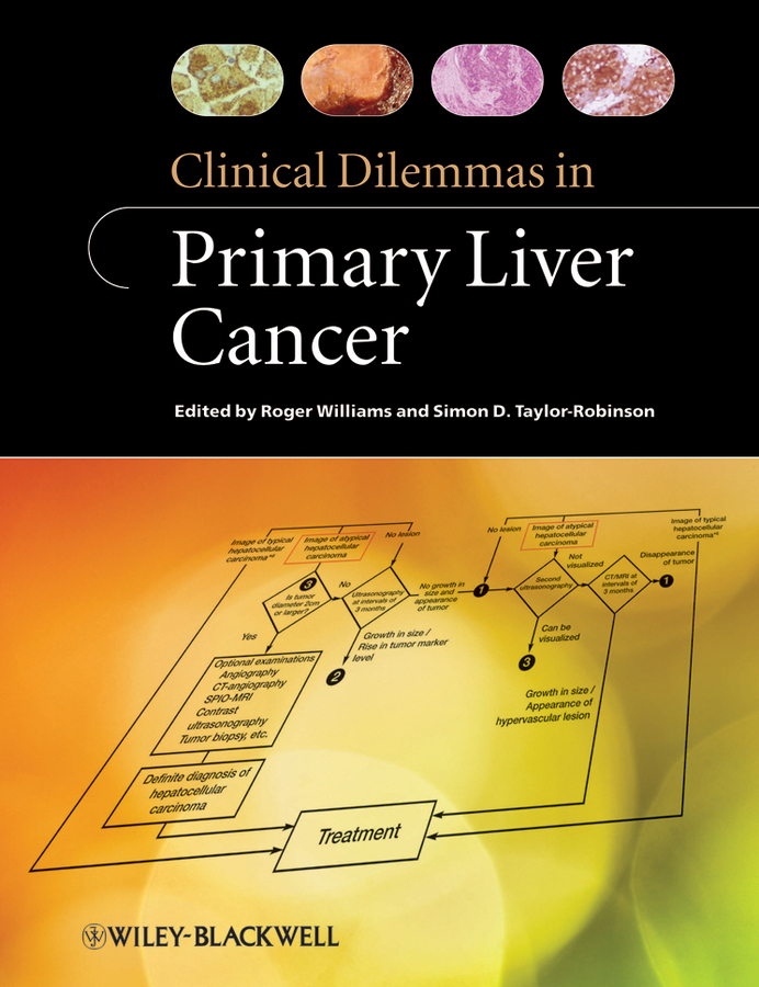 Обложка книги «Clinical Dilemmas in Primary Liver Cancer»