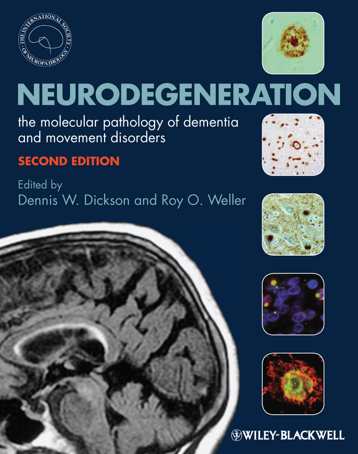 Обложка книги «Neurodegeneration. The Molecular Pathology of Dementia and Movement Disorders»