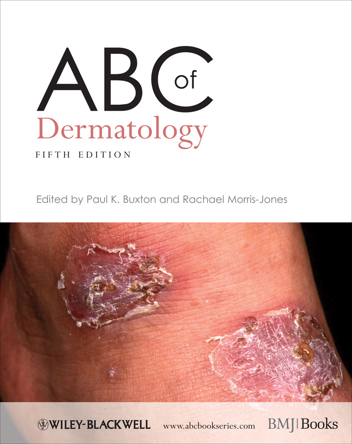 Обложка книги «ABC of Dermatology»