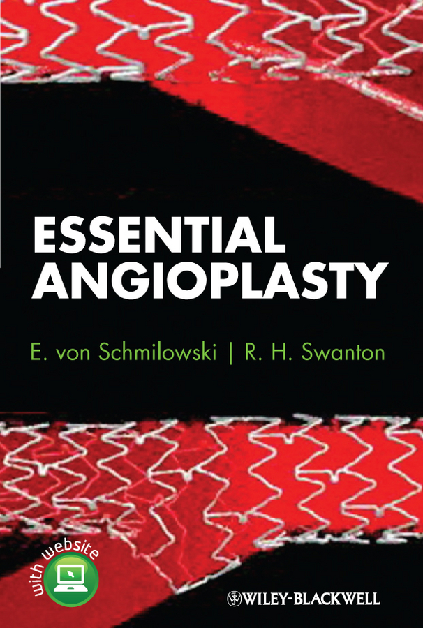 Обложка книги «Essential Angioplasty»