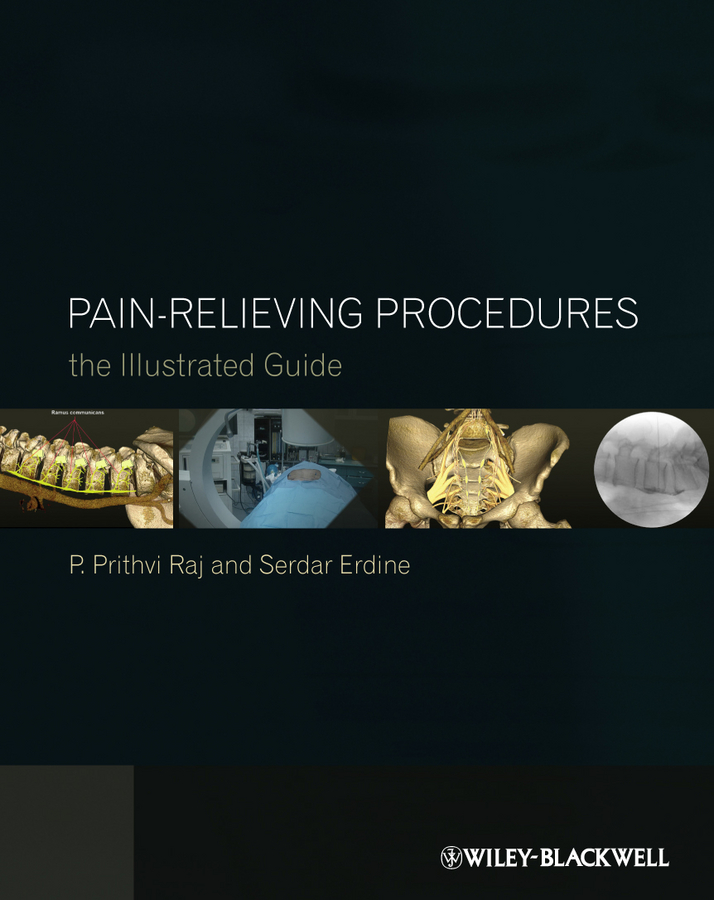 Обложка книги «Pain-Relieving Procedures. The Illustrated Guide»
