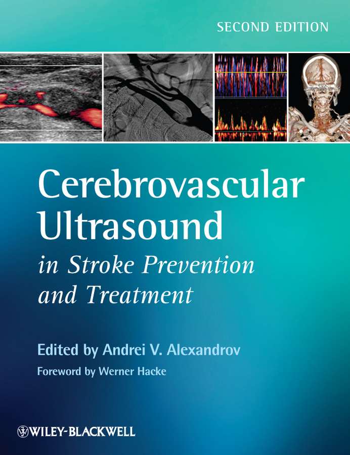 Обложка книги «Cerebrovascular Ultrasound in Stroke Prevention and Treatment»