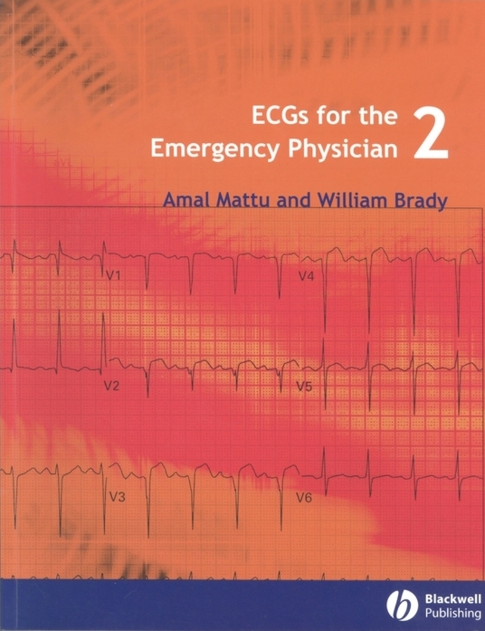 Обложка книги «ECGs for the Emergency Physician 2»