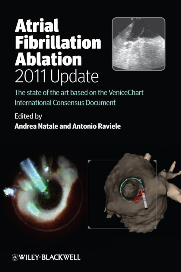 Обложка книги «Atrial Fibrillation Ablation, 2011 Update. The State of the Art based on the VeniceChart International Consensus Document»