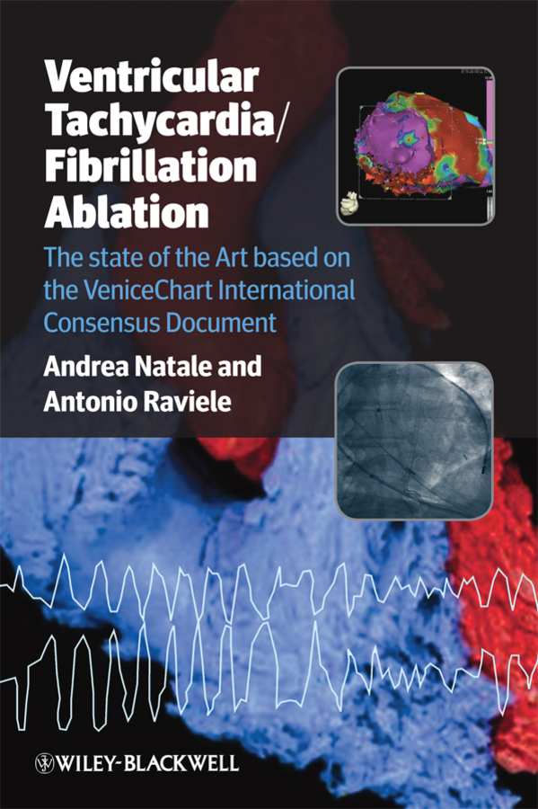 Обложка книги «Ventricular Tachycardia / Fibrillation Ablation. The state of the Art based on the VeniceChart International Consensus Document»