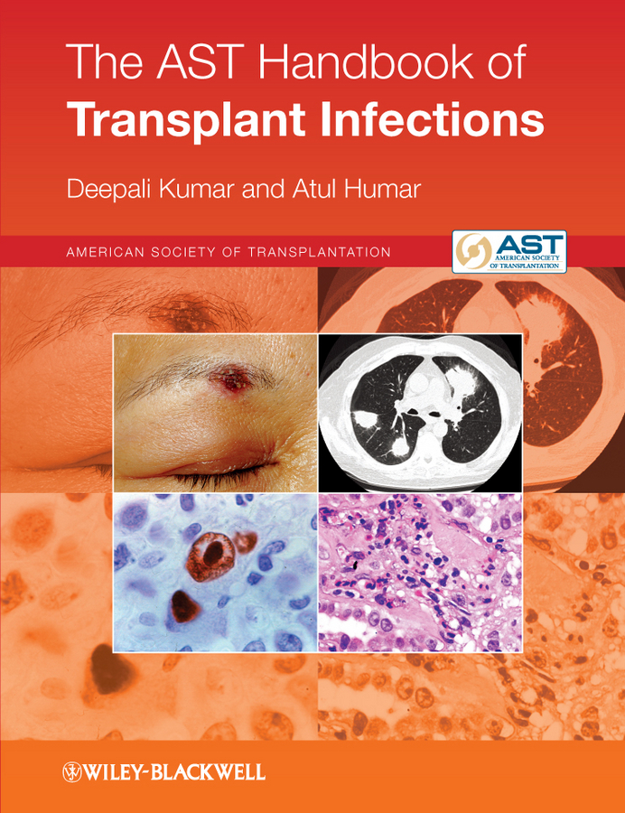 Обложка книги «The AST Handbook of Transplant Infections»