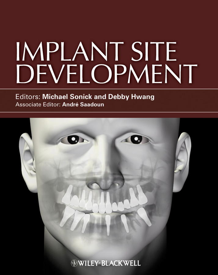Обложка книги «Implant Site Development»