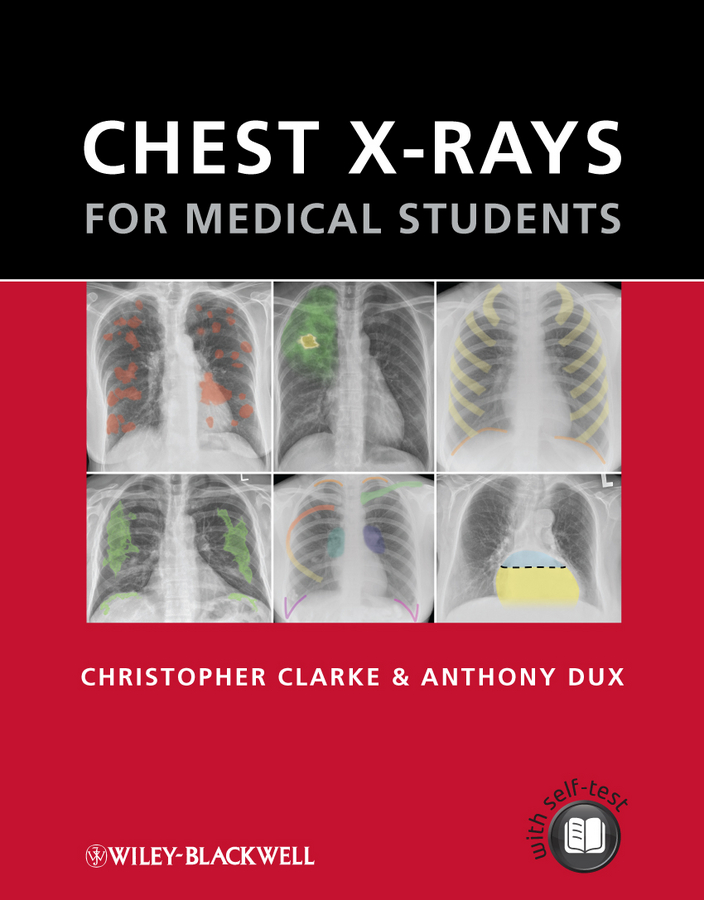 Обложка книги «Chest X-rays for Medical Students»