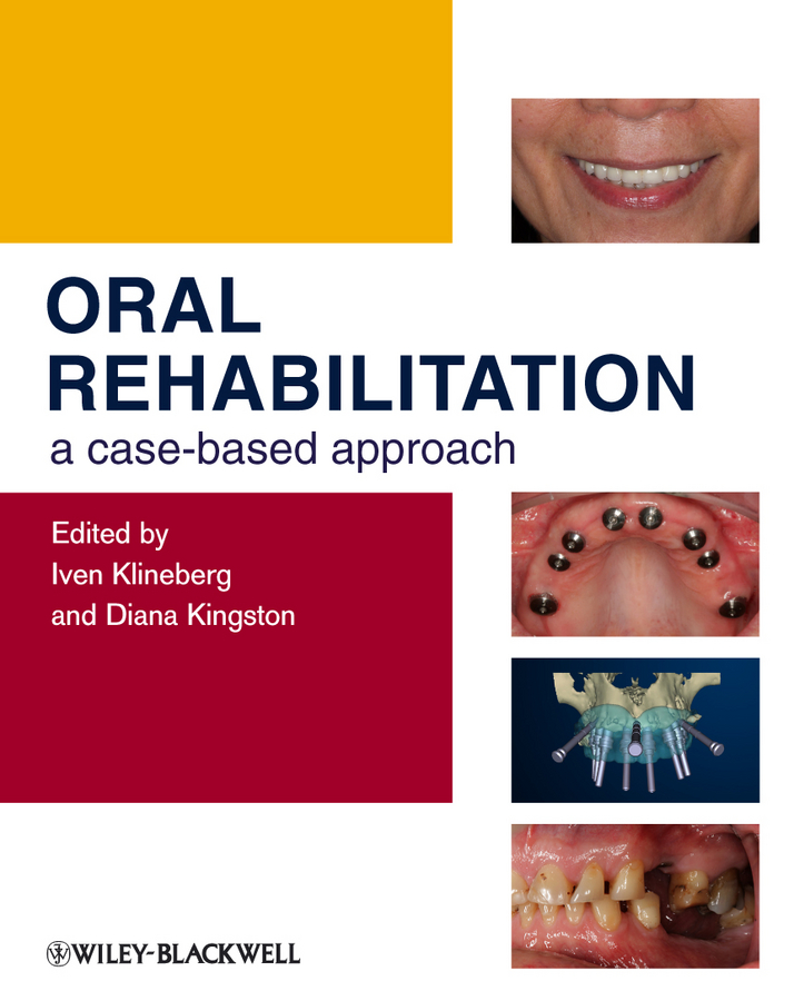 Обложка книги «Oral Rehabilitation. A Case-Based Approach»