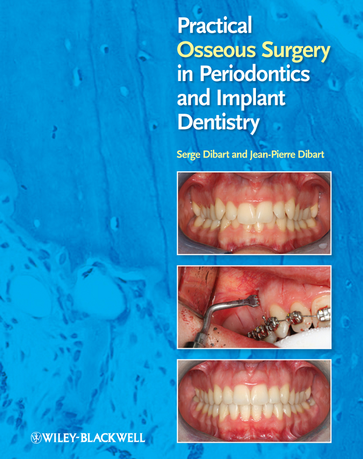 Обложка книги «Practical Osseous Surgery in Periodontics and Implant Dentistry»