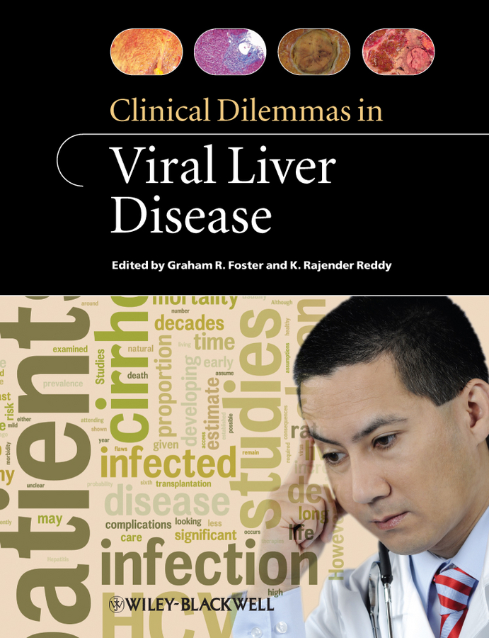 Обложка книги «Clinical Dilemmas in Viral Liver Disease»