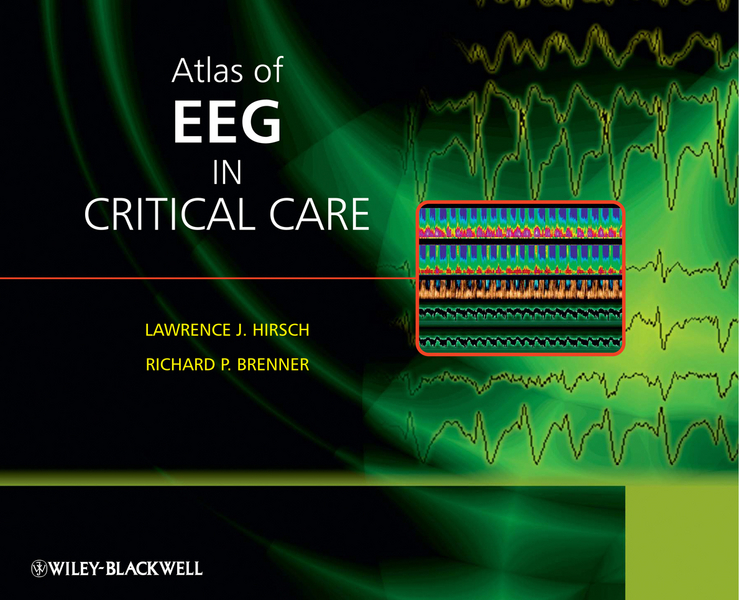 Обложка книги «Atlas of EEG in Critical Care»