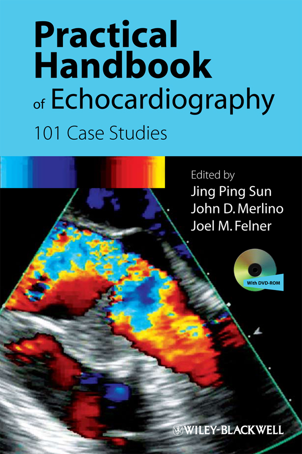 Обложка книги «Practical Handbook of Echocardiography. 101 Case Studies»