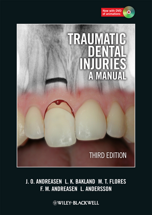 Обложка книги «Traumatic Dental Injuries. A Manual»