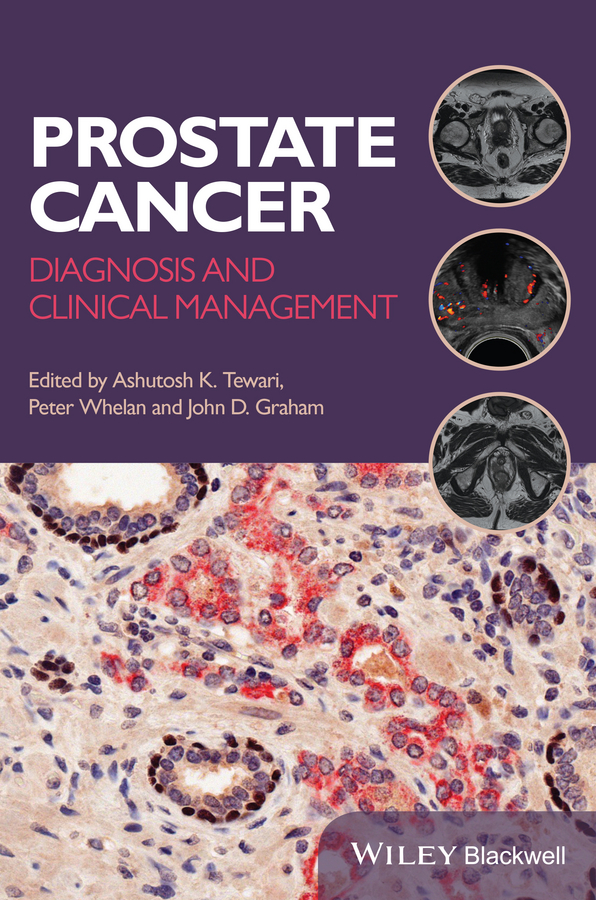 Обложка книги «Prostate Cancer. Diagnosis and Clinical Management»