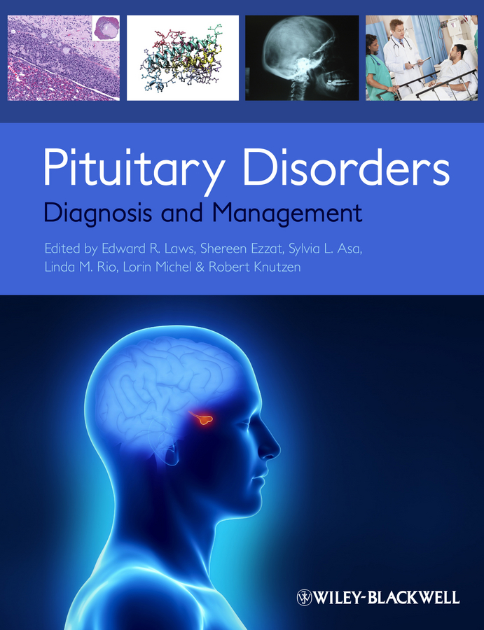 Обложка книги «Pituitary Disorders. Diagnosis and Management»