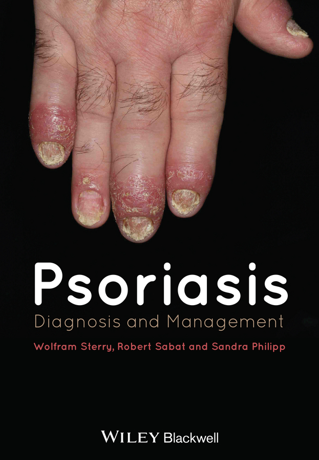 Обложка книги «Psoriasis. Diagnosis and Management»