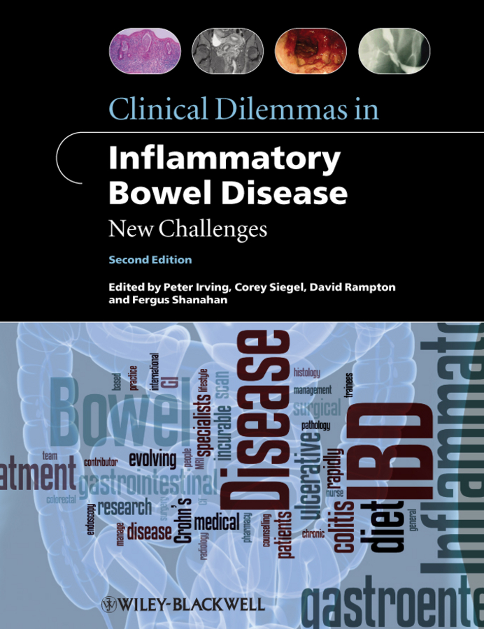 Обложка книги «Clinical Dilemmas in Inflammatory Bowel Disease. New Challenges»