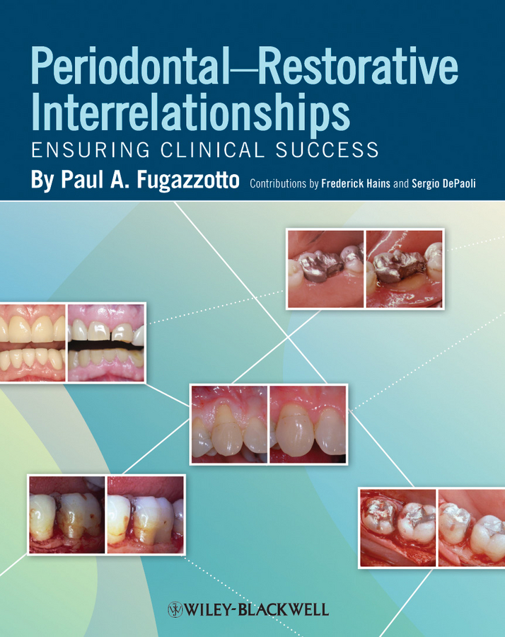 Обложка книги «Periodontal-Restorative Interrelationships. Ensuring Clinical Success»